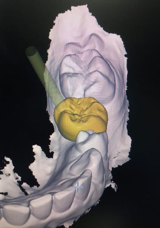 Ortodonzia e gnatologia: immagine illustrativa